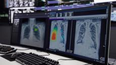 Chest x-ray images being analysed by Lunit INSIGHT CXR software